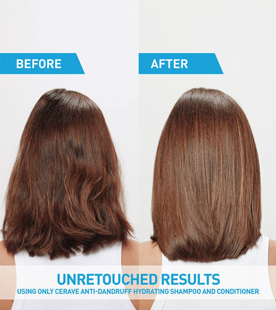 rose essential oil rose essential oil