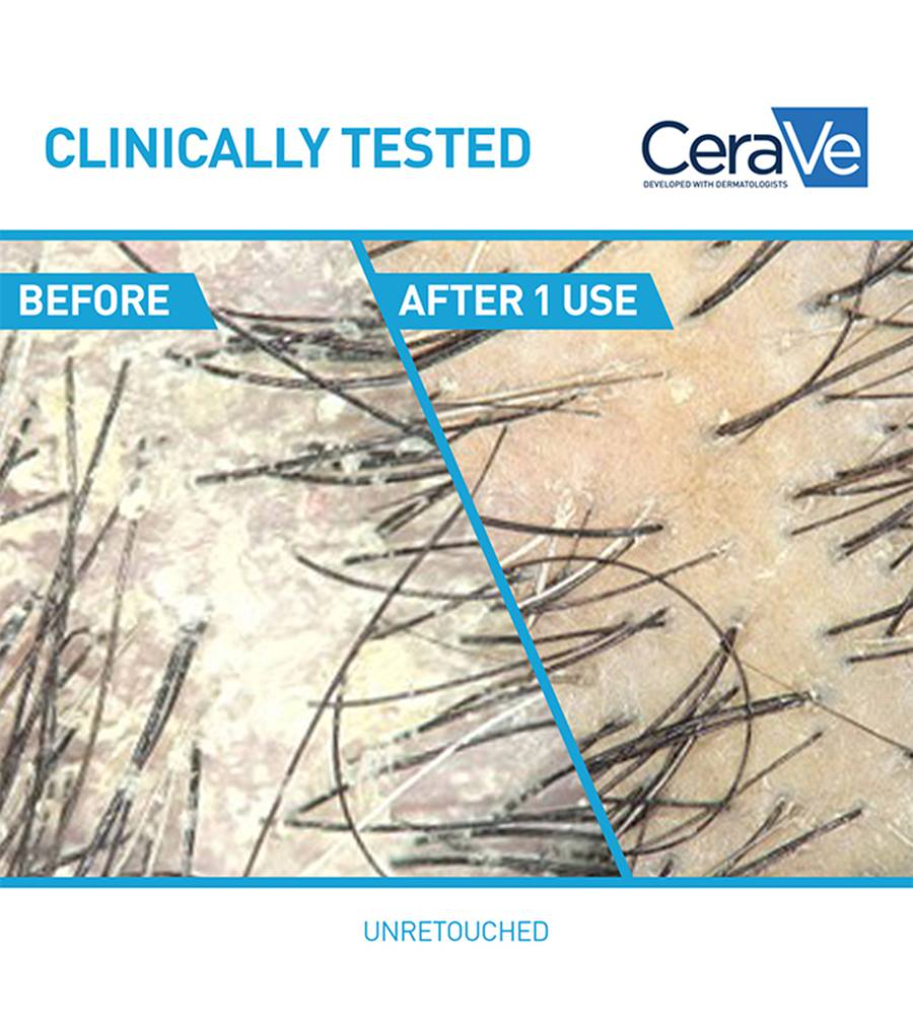 rose essential oil rose essential oil